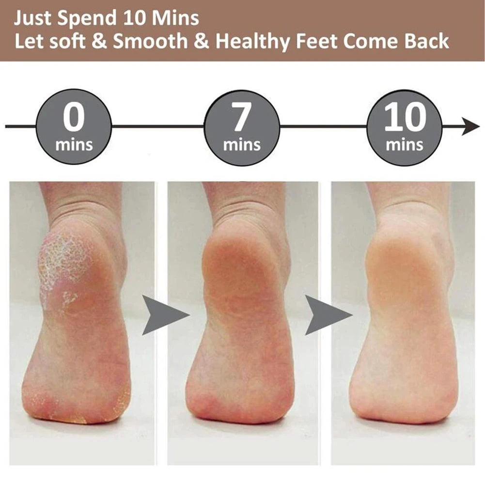 Rechargeable Electric Callus & Foot Exfoliator