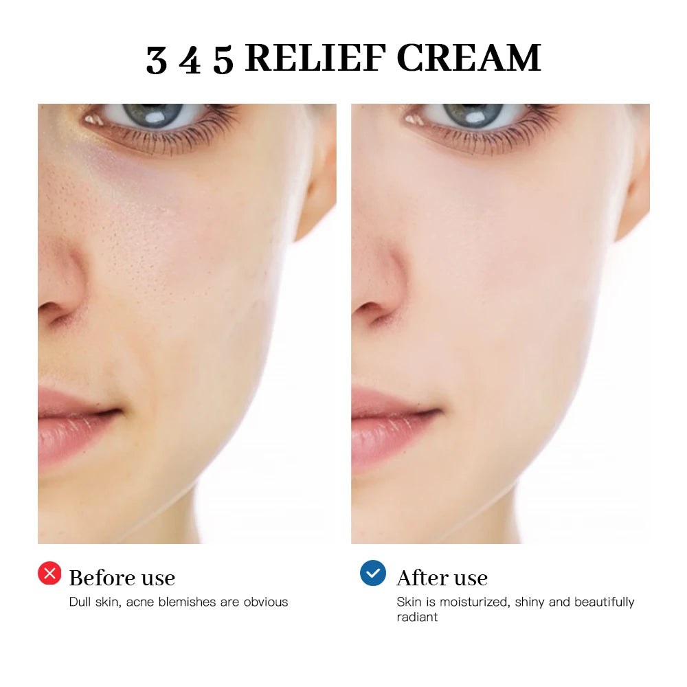345 Anti-Sugar Comprehensive Skin Relief Cream