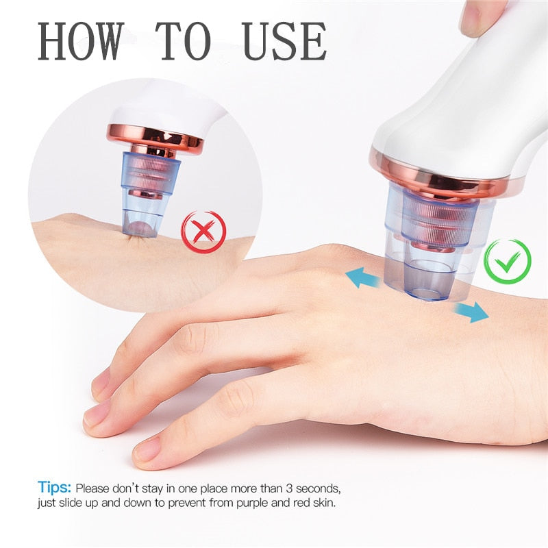Electric Facial Blackhead Remover Vacuum Machine