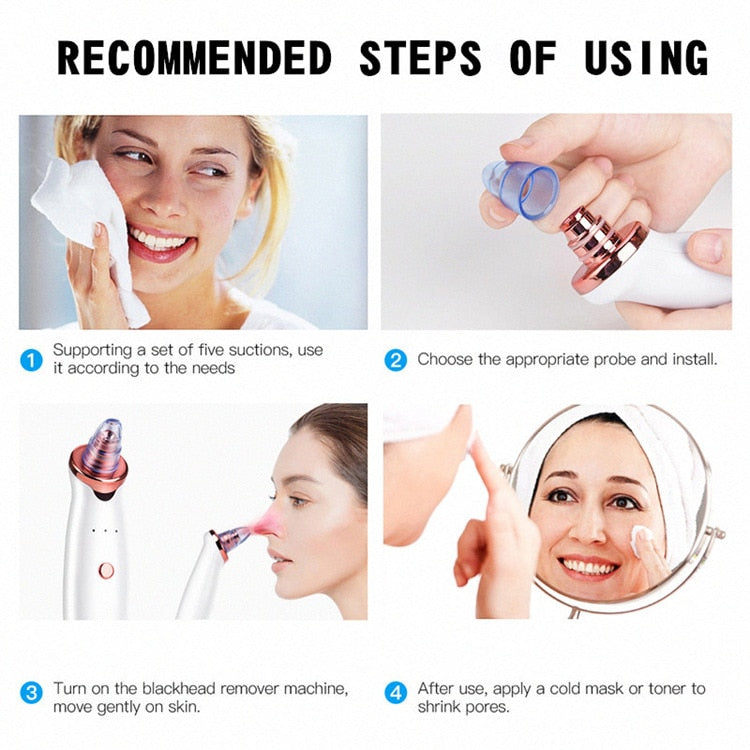 Electric Facial Blackhead Remover Vacuum Machine